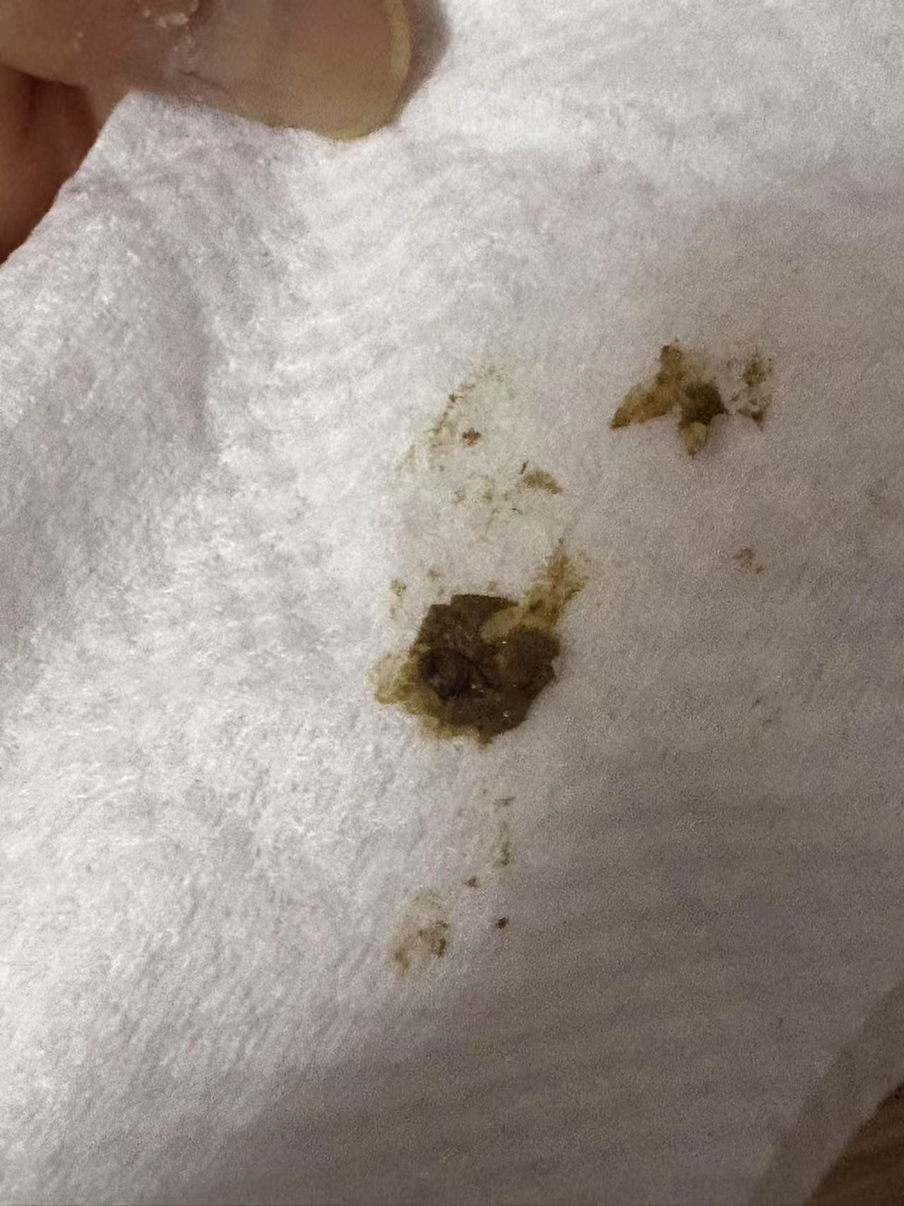 症状描述图片