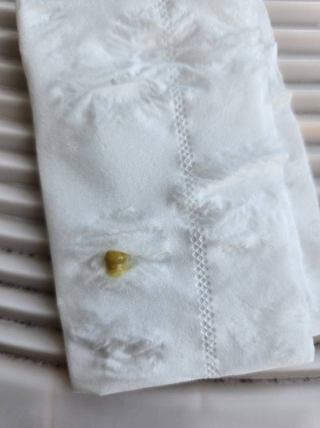 症状描述图片