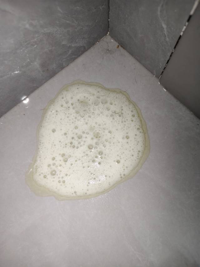 症状描述图片
