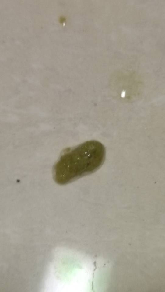 症状描述图片