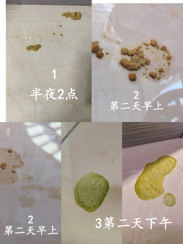 症状描述图片